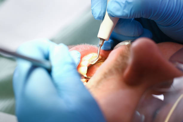 Best Emergency Broken Tooth Repair in Osceola Mills, PA