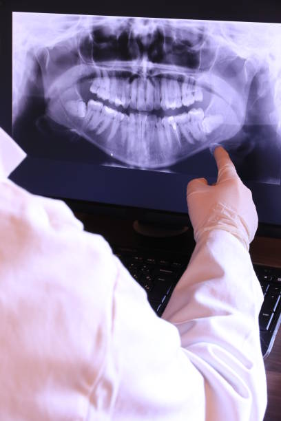 Best Emergency Tooth Extraction in Osceola Mills, PA